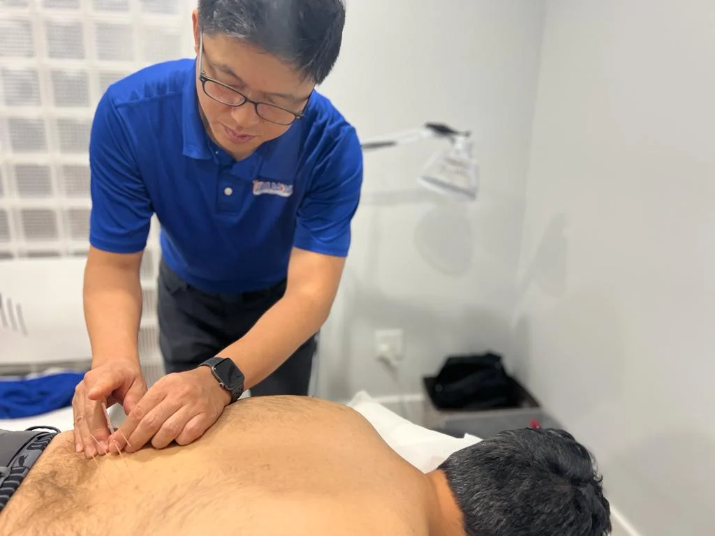 A registered acupuncturist inserting thin needles into a patient's back at Belmont Physiotherapy & Health Clinic.